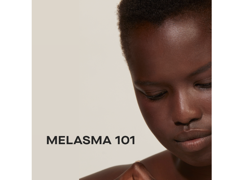Melasma 101
