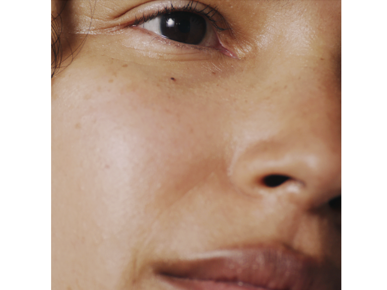 IPL Treatment: What Is It and How Does it Work?