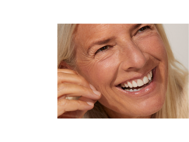 What Is Hyperpigmentation?