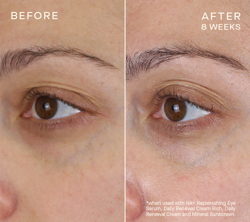 Advanced Regenerative Eye Serum – Ourself