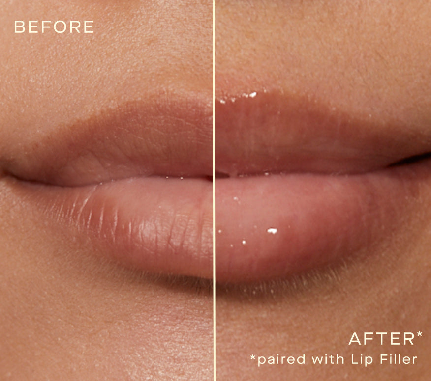 Lip enhancer discount