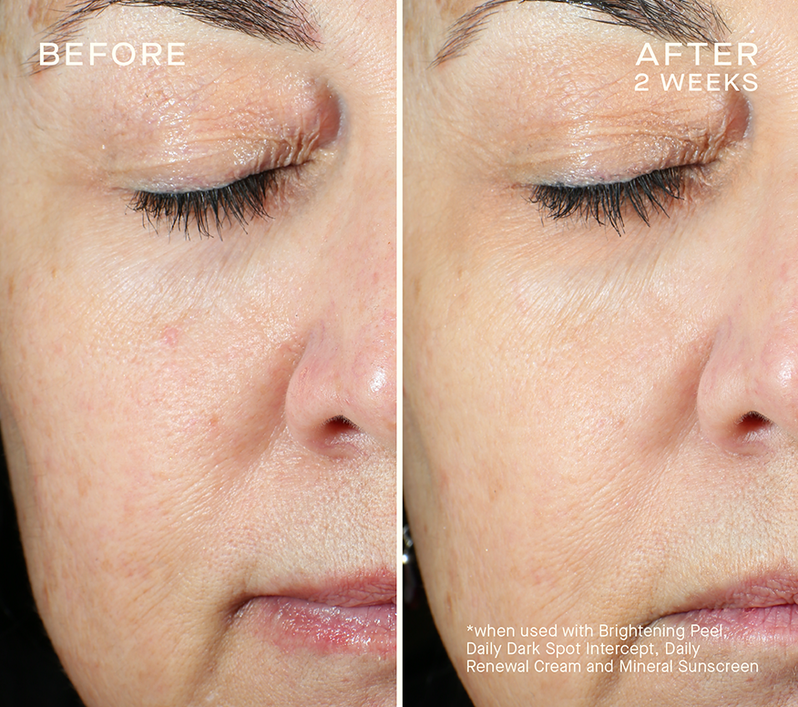 Skin Brightening Peel With Glycolic Acid Ourself