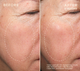 HA+ Replenishing Serum 30mL