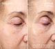 HA+ Replenishing Serum 30mL